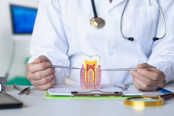 Best Knocked-Out Tooth (Avulsed Tooth) Treatment in Pearl River, LA