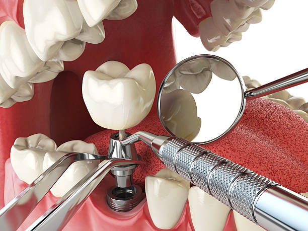 Best Walk-In Emergency Dental Services in Pearl River, LA